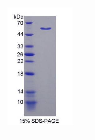 核因子I/B(NFIB)重組蛋白,Recombinant Nuclear Factor I/B (NFIB)