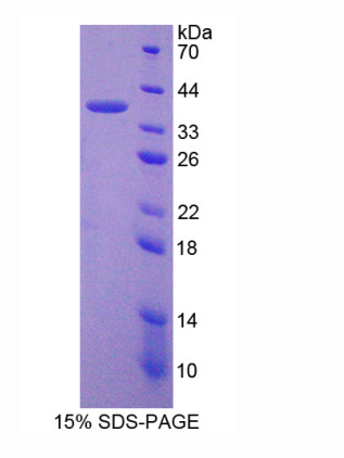 肽基精氨酸脫亞氨酶Ⅵ(PADI6)重組蛋白,Recombinant Peptidyl Arginine Deiminase Type VI (PADI6)