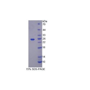 α1-B-糖蛋白(a1BG)重组蛋白,Recombinant Alpha-1-B-Glycoprotein (a1BG)