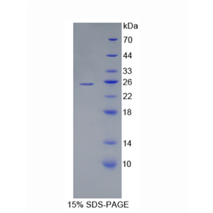 泛素结合酶E2C(UBE2C)重组蛋白,Recombinant Ubiquitin Conjugating Enzyme E2C (UBE2C)