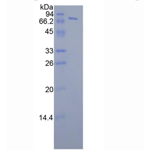 FK506结合蛋白5(FKBP5)重组蛋白
