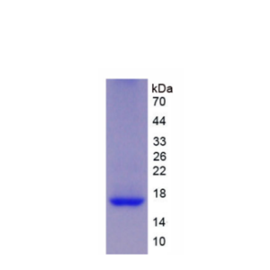 再生胰岛衍生蛋白1β(REG1b)重组蛋白