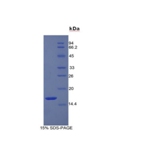 再生胰岛衍生蛋白3α(REG3a)重组蛋白