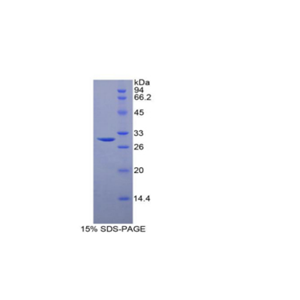 鞘氨醇激酶1(SPHK1)重组蛋白,Recombinant Sphingosine Kinase 1 (SPHK1)