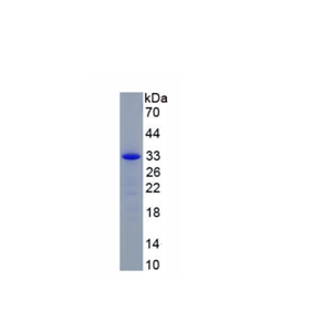 白介素22受体α2(IL22Ra2)重组蛋白