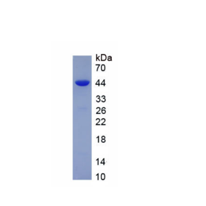 免疫球蛋白A1(IgA1)重组蛋白