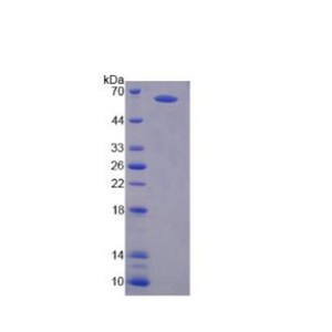 N-甲基-D-天氡氨酸离子能谷氨酸受体2A(GRIN2A)重组蛋白