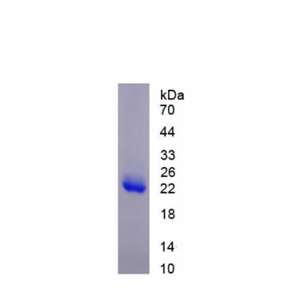 组蛋白脱乙酰基酶6(HDAC6)重组蛋白