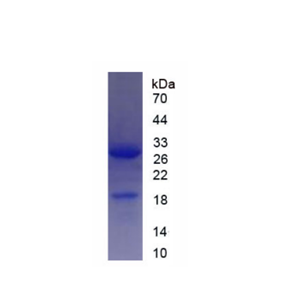 沉默调节蛋白1(SIRT1)重组蛋白