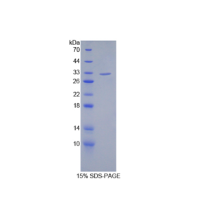 沉默调节蛋白3(SIRT3)重组蛋白,Recombinant Sirtuin 3 (SIRT3)