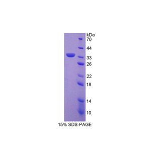 沉默调节蛋白5(SIRT5)重组蛋白