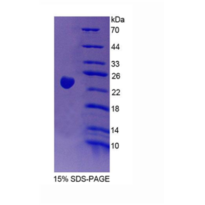 Vav3癌基因(VAV3)重组蛋白,Recombinant Vav 3 Oncogene (VAV3)