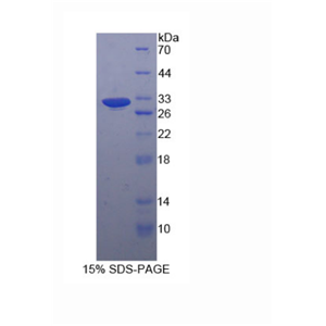 丝蛋白Bβ(FLNb)重组蛋白,Recombinant Filamin B Beta (FLNb)