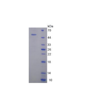 精氨酸/丝氨酸丰富剪接因子2(SRSF2)重组蛋白