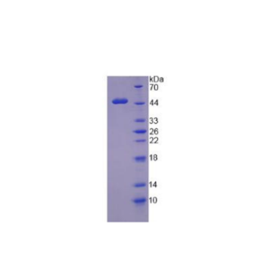 肾母细胞瘤蛋白1(WT1)重组蛋白