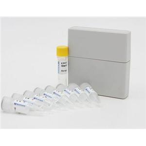 黄瓜黑星病菌PCR试剂盒