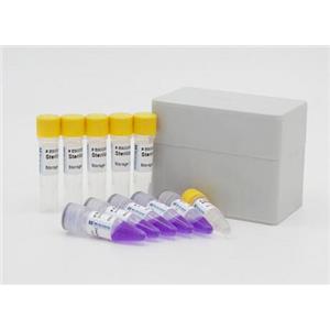 卡氏枝孢霉探针法荧光定量PCR试剂盒