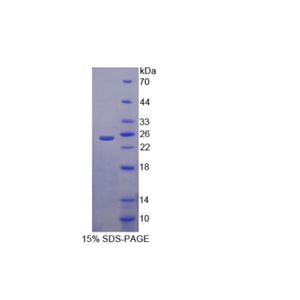 输出蛋白5(XPO5)重组蛋白