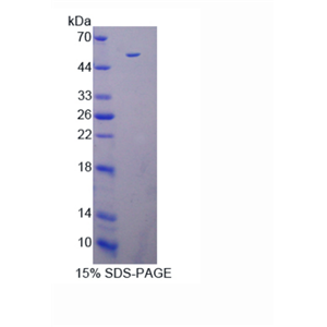 死亡關聯(lián)蛋白激酶3(DAPK3)重組蛋白,Recombinant Death Associated Protein Kinase 3 (DAPK3)