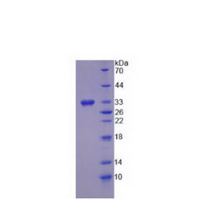 17-β-羟基类固醇脱氢酶3(HSD17b3)重组蛋白