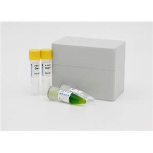 漏斗状带绦虫探针法荧光定量PCR试剂盒,Choanotaenia infundibulum