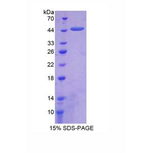 羧肽酶A2(CPA2)重组蛋白,Recombinant Carboxypeptidase A2, Pancreatic (CPA2)