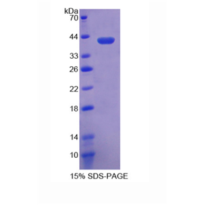 晶状体蛋白λ1(CRYl1)重组蛋白,Recombinant Crystallin Lambda 1 (CRYl1)