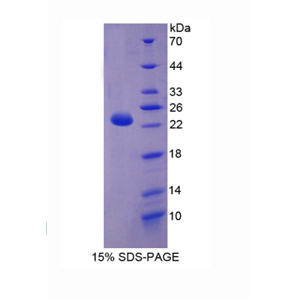 肉毒碱棕榈酰基转移酶1B(CPT1B)重组蛋白,Recombinant Carnitine Palmitoyltransferase 1B, Muscle (CPT1B)