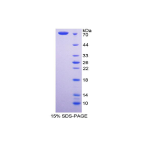 衰老关键蛋白4(FBLN4)重组蛋白,Recombinant Fibulin 4 (FBLN4)