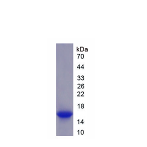 透明质酸合酶2(HAS2)重组蛋白