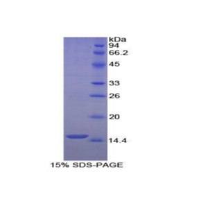 唾液富组蛋白1(HTN1)重组蛋白