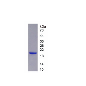 核纤层蛋白A/C(LMNA)重组蛋白