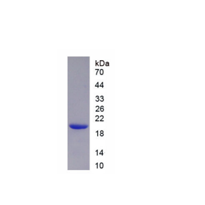 核纖層蛋白A/C(LMNA)重組蛋白