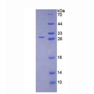 赖氨酰氧化酶样蛋白1(LOXL1)重组蛋白,Recombinant Lysyl Oxidase Like Protein 1 (LOXL1)