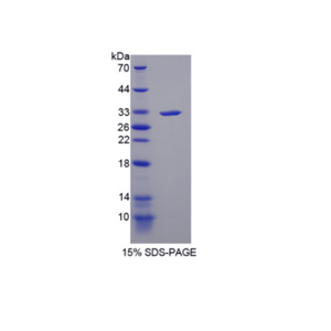 赖氨酰氧化酶样蛋白4(LOXL4)重组蛋白,Recombinant Lysyl Oxidase Like Protein 4 (LOXL4)