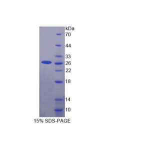 尿溶蛋白3A(UPK3A)重组蛋白,Recombinant Uroplakin 3A (UPK3A)