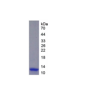 黑素皮质激素5受体(MC5R)重组蛋白