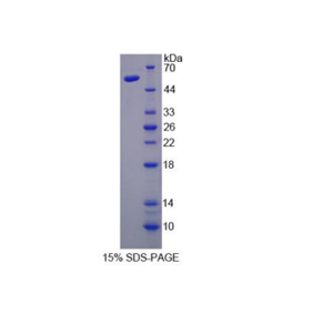 核转录因子Y亚基γ(NFYC)重组蛋白,Recombinant Nuclear Transcription Factor Y Gamma (NFYC)