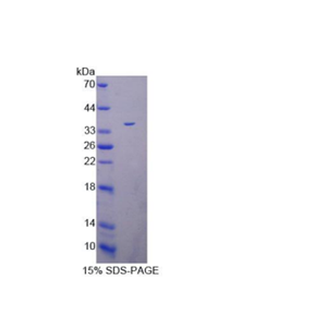 肽基精氨酸脱亚氨酶Ⅳ(PADI4)重组蛋白
