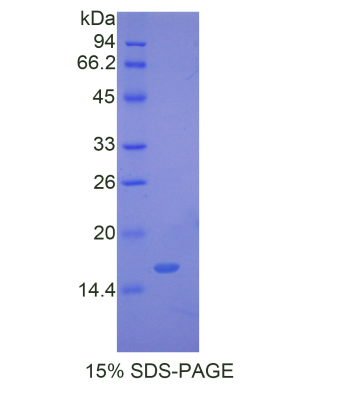 葡萄糖磷酸變位酶5(PGM5)重組蛋白,Recombinant Phosphoglucomutase 5 (PGM5)