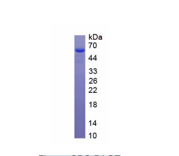 外周蛋白(PRPH)重组蛋白,Recombinant Peripherin (PRPH)