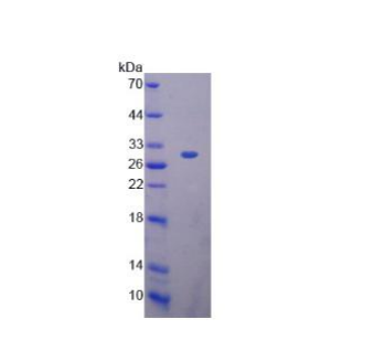 过氧化还原酶4(PRDX4)重组蛋白,Recombinant Peroxiredoxin 4 (PRDX4)