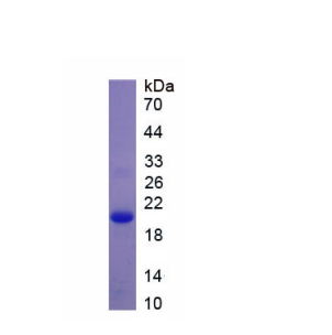 过氧化还原酶5(PRDX5)重组蛋白,Recombinant Peroxiredoxin 5 (PRDX5)