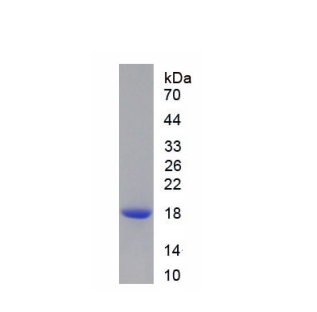 过氧化还原酶2(PRDX2)重组蛋白,Recombinant Peroxiredoxin 2 (PRDX2)