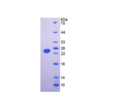 轉(zhuǎn)化受體電位陽離子通道亞家族V成員1(TRPV1)重組蛋白,Recombinant Transient Receptor Potential Cation Channel Subfamily V, Member 1 (TRPV1)