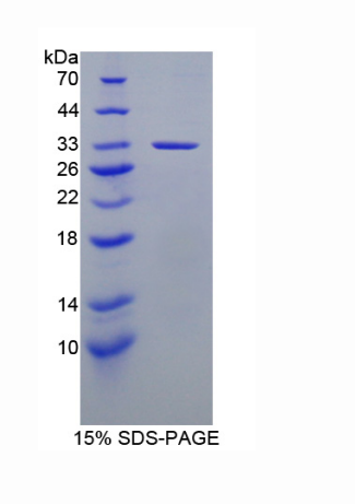 轉(zhuǎn)化受體電位陽離子通道亞家族V成員2(TRPV2)重組蛋白,Recombinant Transient Receptor Potential Cation Channel Subfamily V, Member 2 (TRPV2)