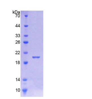 钙调蛋白样蛋白5(CALML5)重组蛋白,Recombinant Calmodulin Like Protein 5 (CALML5)