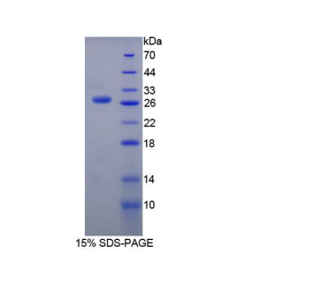 含硬化蛋白域蛋白1(SOSTDC1)重组蛋白,Recombinant Sclerostin Domain Containing Protein 1 (SOSTDC1)