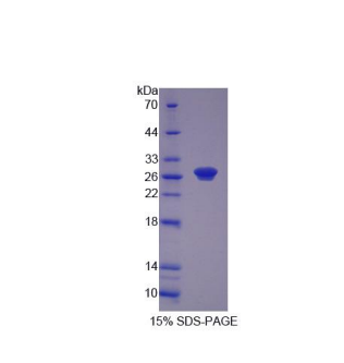 核苷酸还原酶M1(RRM1)重组蛋白,Recombinant Ribonucleotide Reductase M1 (RRM1)