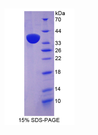 核膜含血影蛋白重复蛋白2(Nesp2)重组蛋白,Recombinant Nesprin 2 (Nesp2)